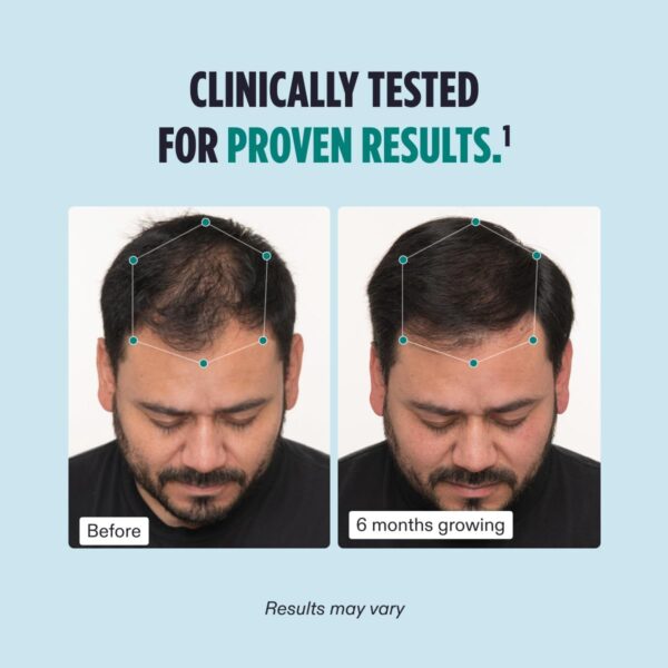 Nutrafol Men Hair Growth Supplement for Thicker, Stronger Hair - Image 4