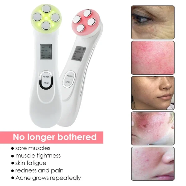 EMS Facial Lift Massager 5 Color LED Facial Beauty Device Microcurrent - Image 5
