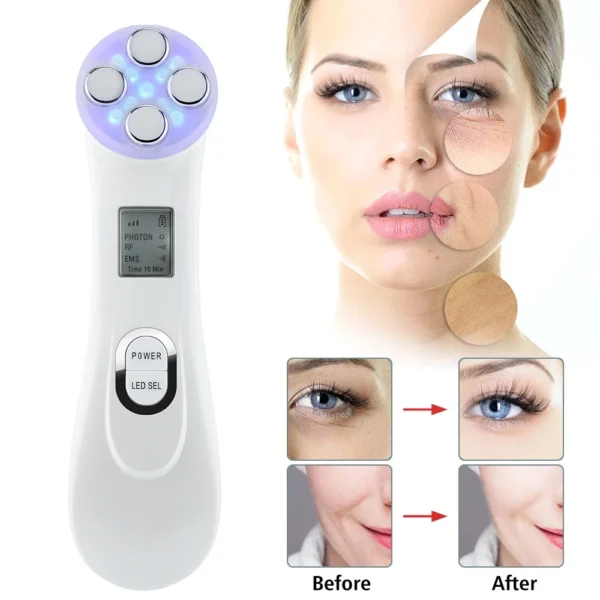 EMS Facial Lift Massager 5 Color LED Facial Beauty Device Microcurrent - Image 2