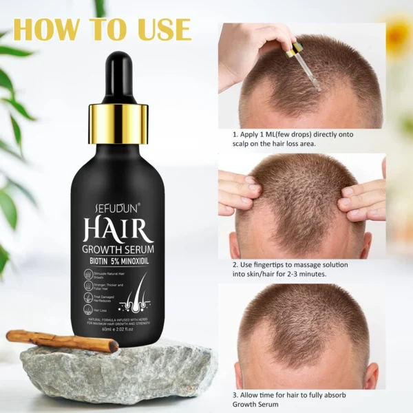 5% Minoxidil Hair Growth Oil with Biotin - For Men & Women, 2.02 Fl. Oz - - Image 4